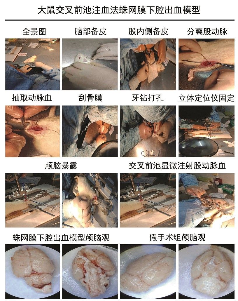 大鼠交叉前池注血法蛛網(wǎng)膜下腔出血模型