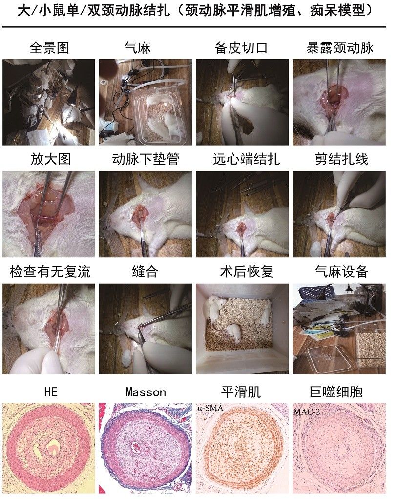 頸動(dòng)脈平滑肌增殖 、癡呆模型 
